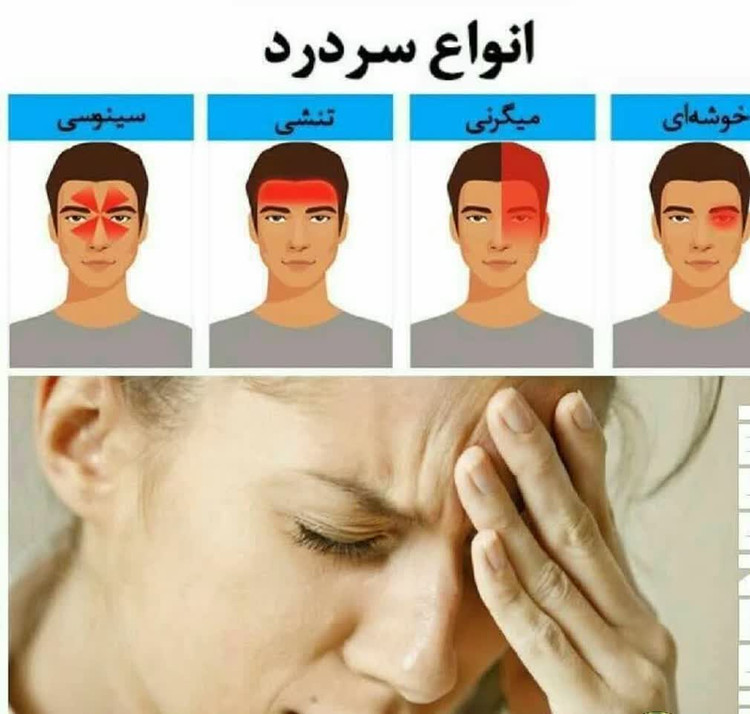 روغن هلکسیر درمان تسکین سردرد و میگرن برند اکسونیک مستقیم از نمایندگی ایران زمین اصل و اورجینال